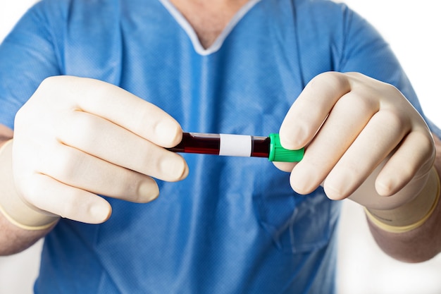 Lekarz Trzymający Probówkę Z Próbką Krwi. Badania I Analizy Medyczne, Koncepcja Coronavirus 2019-ncov