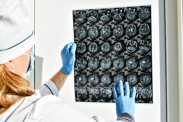 Lekarz w rękawicach ochronnych trzymając MRI mózgu w gabinecie lekarskim. MRI głowy ludzkiej w klinice. Profesjonalny lekarz mózgu udziela pacjentowi doradcy