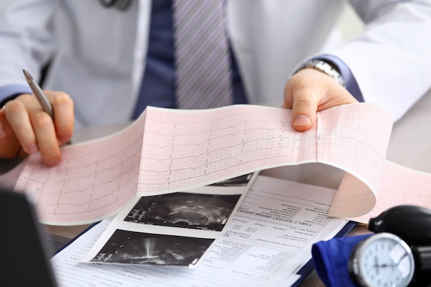 Zdjęcie lekarz wyjaśnia dane kardiogramu, konsultacje. powtarzana konsultacja, lekarz opracowuje optymalny schemat leczenia, wyjaśnia, jak właściwie kontrolować stan zdrowia. zapobieganie, leczenie chorób serca.