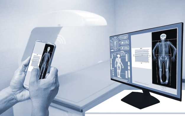 Lekarz z bliska używa smartfona, aby sprawdzić obraz gęstości kości DXA na monitorze u kobiety, aby zapobiec osteoporozie, rozmyte tło maszyny do densytometru kościKoncepcja technologii medycznej