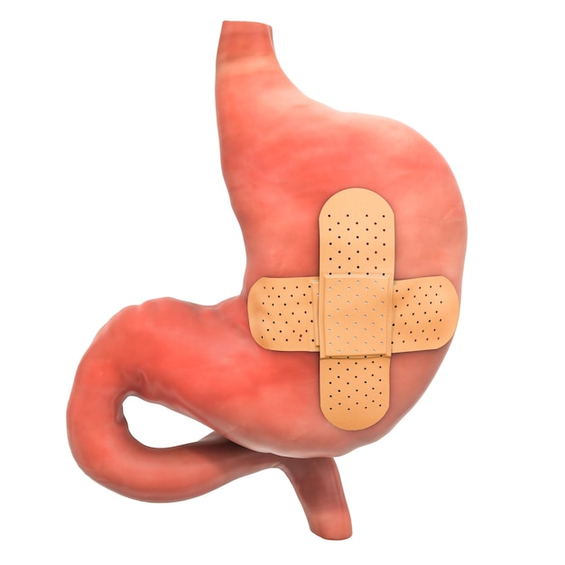Zdjęcie ludzki żołądek z klejącymi się bandażami leczenie koncepcji żołądka renderowanie 3d