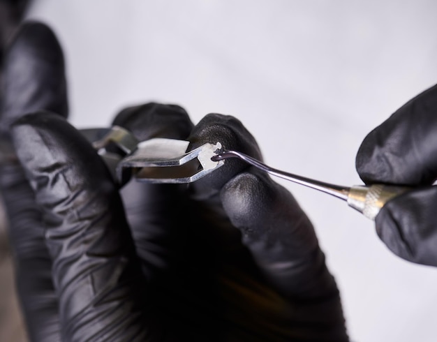 Makro zdjęcie ortodontycznego podkładka ceramicznego w rękach dentysty w czarnych rękawiczkach lateksowych Proces nakładania pasty klejącej na podkładkę przed instalacją Koncepcja leczenia ortodontycznego