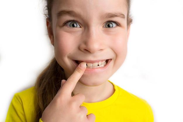 Mała dziewczynka stoi na białym tle z pięknym uśmiechem, dziećmi krzywymi zębami, stomatologią dziecięcą. Zbliżenie krzywe zęby. Konieczna jest korekcja wad zgryzu. Zdjęcie wysokiej jakości