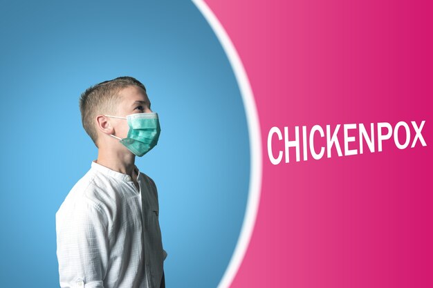 Mały chłopiec w masce medycznej na jasnym tle z napisem CHICKENPOX