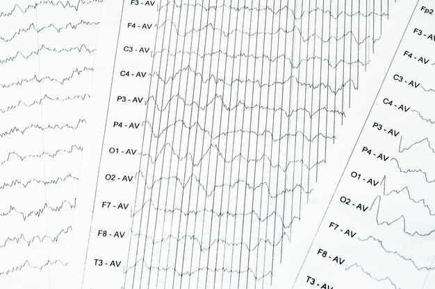 Zdjęcie metoda monitorowania elektrofyzyologicznego fali eeg w ludzkim mózgu