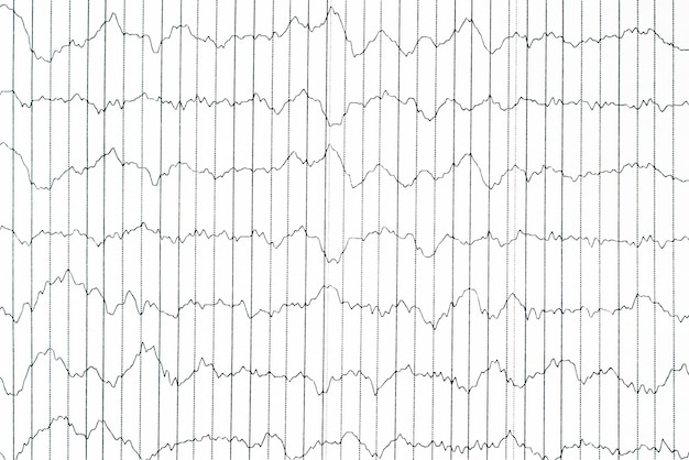 Zdjęcie metoda monitorowania elektrofyzyologicznego fali eeg w wzorach fal mózgowych ludzkiego mózgu