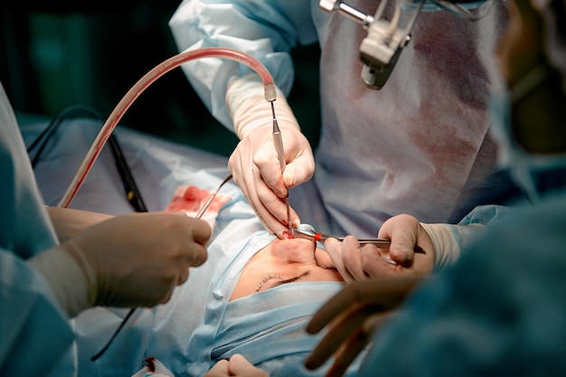 Mężczyźni Po Operacji Nosa, Dłonie Chirurga W Rękawiczkach Trzymają Instrumenty Podczas Operacji Nosa. Lekarz W Rękawiczkach Trzyma Instrument Medyczny Podczas Korekcji Nosa.