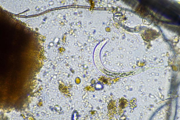 Zdjęcie mikroorganizmy glebowe pod mikroskopem mikroorganizmy z grzybami w komposcie