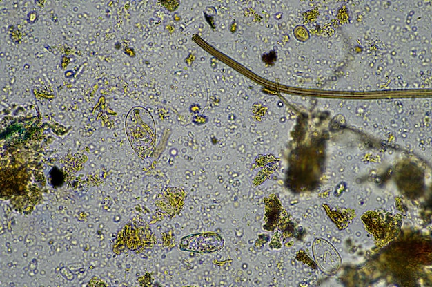 Mikroorganizmy i biologia w kompozycie i próbce gleby pod mikroskopem
