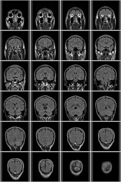 Miniatura Głowy Mri