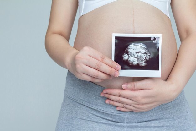 Młoda kobieta w ciąży trzymająca USG w ostatnim trymestrze ciąży