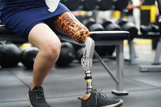 Zdjęcie młoda kobieta z jedną protetyczną nogą z praktyką używania protetycznych nóg do ćwiczeń chodzenia