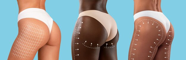 Zdjęcie młode europejskie kobiety rasy czarnej rasy mieszanej w bikini o szczupłym ciele z liniami do modelowania sylwetki lub masażu drenażowego