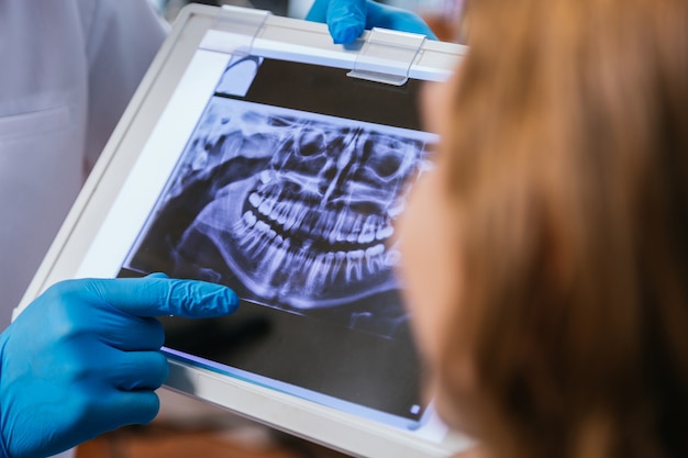 Młody dentysta pokazuje swojemu pacjentowi zdjęcie rentgenowskie przed interwencją medyczną w klinice