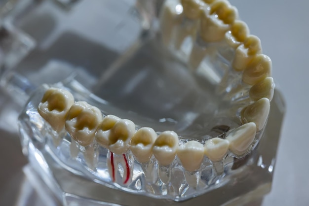 Zdjęcie model dentystyczny przedstawia powszechne choroby zębów, takie jak próchnica zęba mądrości zdrowie jamy ustnej kopiować przestrzeń