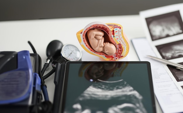 Zdjęcie model macicy i tabletka z ultradźwiękiem na stole