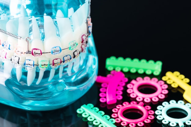 Zdjęcie model ortodontyczny i narzędzie dentystyczne - model zębów demonstracyjnych o zróżnicowanych kształtach ortodontycznych