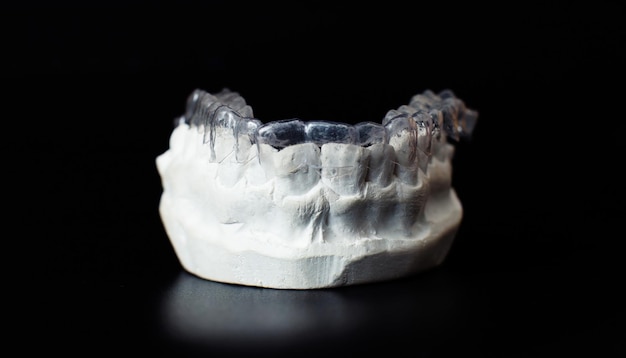 Model szczęki dentystycznej na czarnym tle Przezroczyste, niewidoczne nakładki dentystyczne lub aparaty ortodontyczne odpowiednie do leczenia ortodontycznego