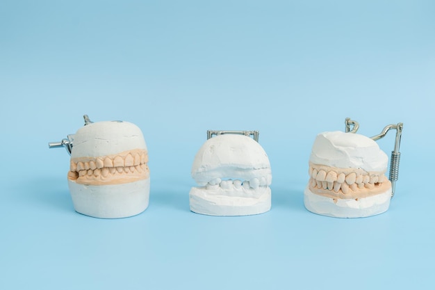 Model zębów i dziąseł na niebieskim tle Koncepcja stomatologiczna