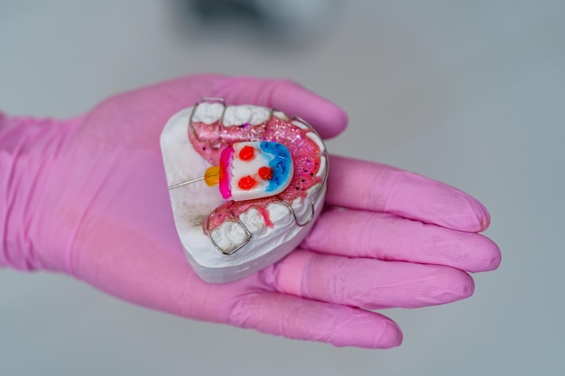 Model zębów na dłoni na rozmytym tle Plastikowe zęby w jednym rzędzie z widocznymi łącznikami Ludzka szczęka do treningu stomatologicznego