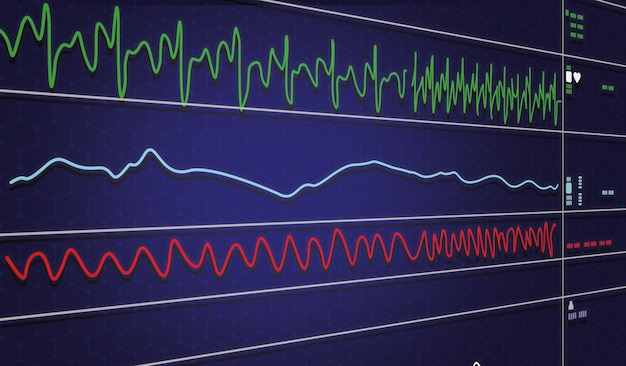 Monitor Ekg W Maszynie Z Pompą Balonową Wewnątrz Aorty W Icu Na Rozmyciu Tła, Fale Mózgowe W Elektroencefalogramie, Fala Tętna