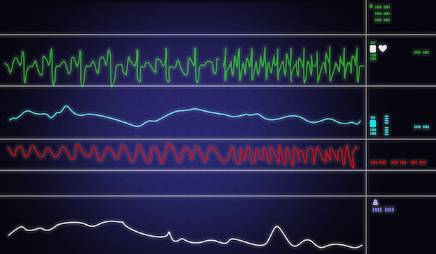 Monitor pacjenta pokazujący parametry życiowe EKG i EKG. Ilustracja wektorowa.