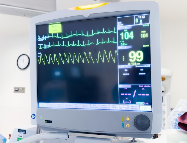 Zdjęcie monitor szpitalny wyświetla parametry życiowe, tętno i dane hemodynamiczne ilustrujące współczesny stan zdrowia