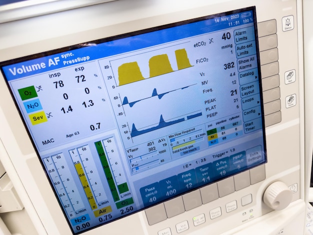 Zdjęcie monitor szpitalny wyświetlający oznaki życiowe tętno ciśnienie krwi temperatura tlenowania i