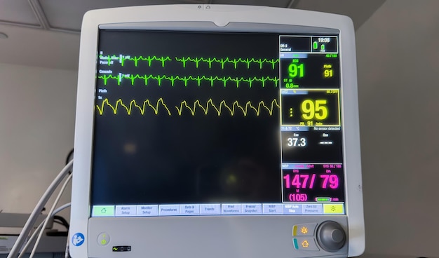 Zdjęcie monitor szpitalny wyświetlający parametry życiowe, tętno, tętno, temperaturę, ciśnienie krwi, symbo