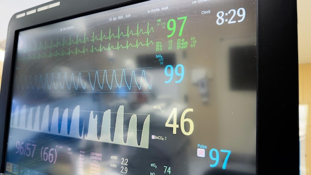 Monitor z ekranem pokazującym godzinę 8:29 i 37