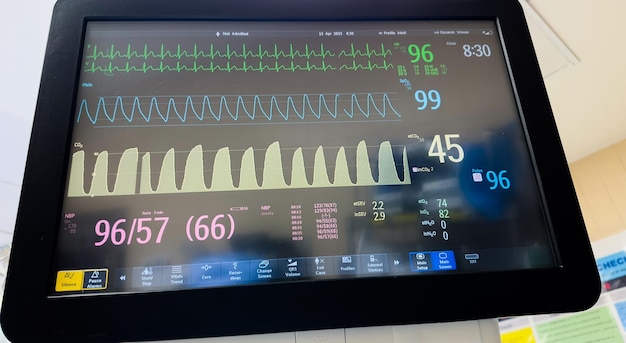 Zdjęcie monitor z numerem 69