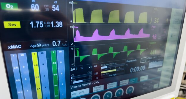 Zdjęcie monitoruj sprzęt medyczny szpitala wyświetlający znaki życiowe, takie jak tętno, ciśnienie krwi i tlen