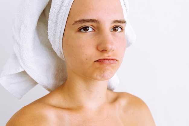 Nastoletnia dziewczyna z nastoletnim trądzikiem na twarzy, z ręcznikiem kąpielowym na włosach, ze smutnym wyrazem twarzy