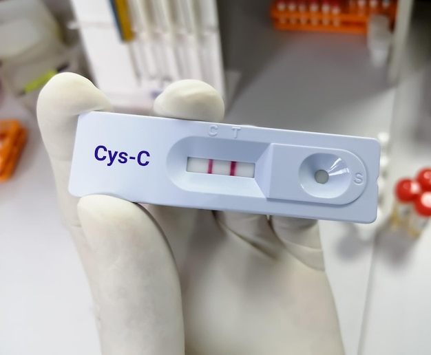 Naukowiec trzyma urządzenie testowe lub kasetę do testu cystatyny C w celu zdiagnozowania PChN