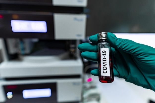 Naukowiec trzymający Probówkę z próbką krwi do testu COVID19Eksperyment na wykrycie wirusa we krwi