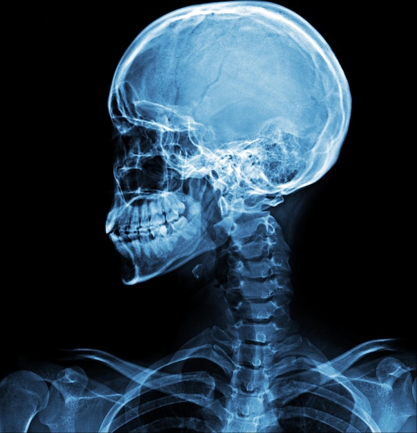 Niebieski obraz ludzkiej głowy z napisem „kość”.