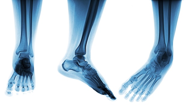 Niebieski obraz ludzkiej stopy i kości.