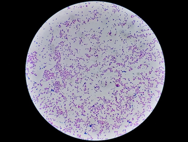 Obraz mikroskopowy barwnika gramowego przedstawiający bakterie Escherichia coli lub E coli