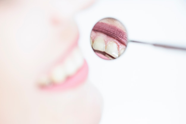 Zdjęcie odbicie kobieta zęby w dentysty lustrze