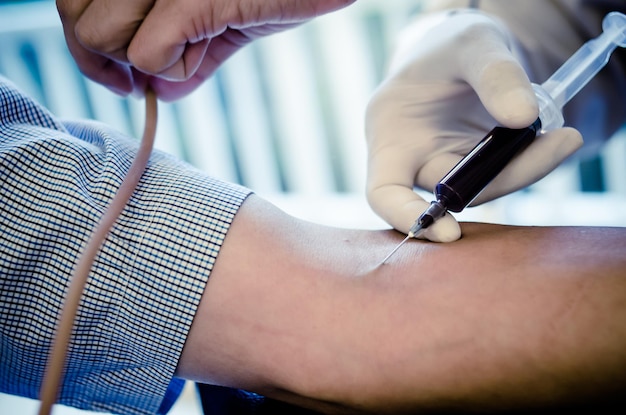Odcięta ręka lekarza pobierającego próbki krwi z ramienia pacjenta