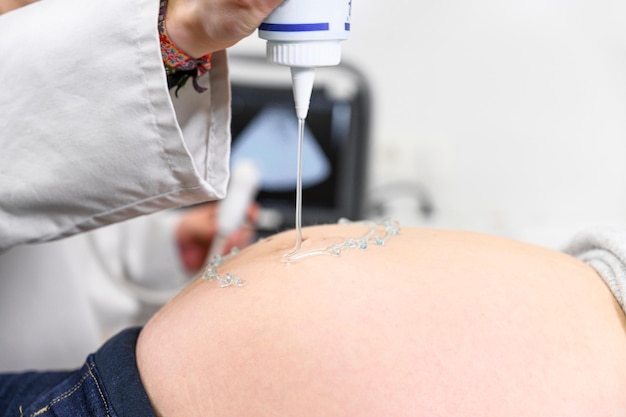 Zdjęcie odcięta ręka lekarza wylewającego płyn na brzuch kobiety w ciąży