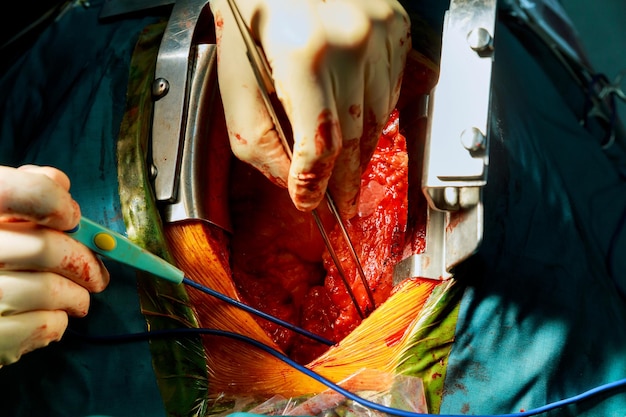 Zdjęcie odcięte ręce lekarza wykonującego operację pacjenta w szpitalu