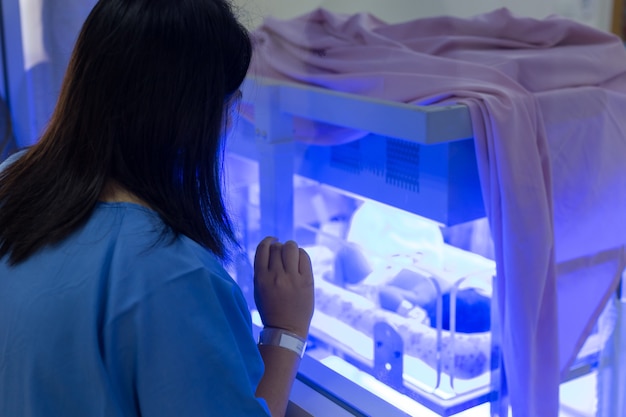 Oglądanie matki u noworodka z hiperbilirubinemią / żółtaczka noworodków pod niebieskim światłem UV