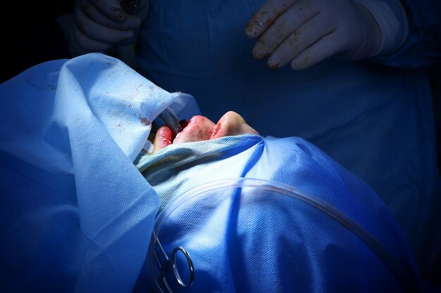 Operacja pacjenta w nowoczesnym szpitalu