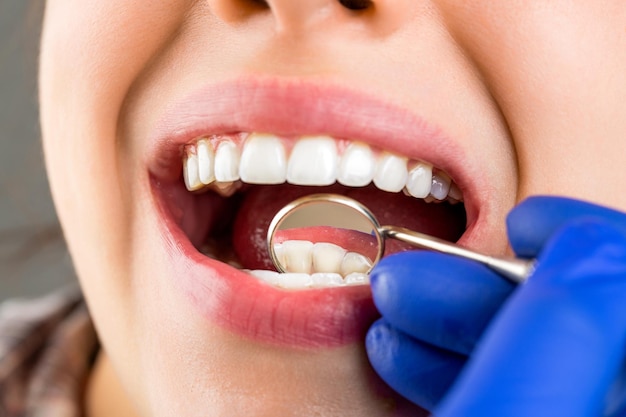 Opieka stomatologiczna dbanie o zęby Dziewczyna badająca zęby u dentystów Kobieta w klinice stomatologicznej z dentystą Koncepcja zdrowych zębów Dbanie o zęby Kobieta u dentysty