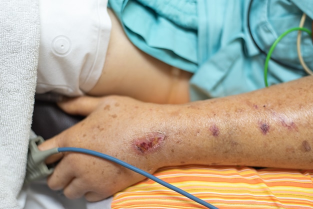 Zdjęcie pacjent w szpitalu z pulsometrem na palcu
