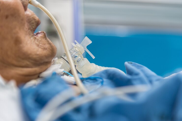 Pacjent wykonuje tracheostomię i respirator w szpitalu