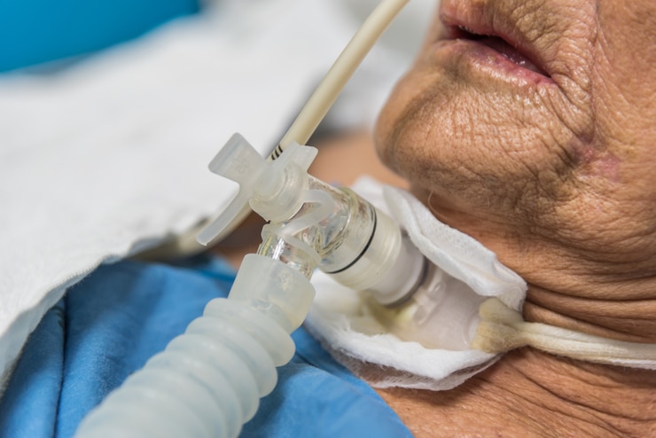 Pacjent wykonuje tracheostomię i respirator w szpitalu