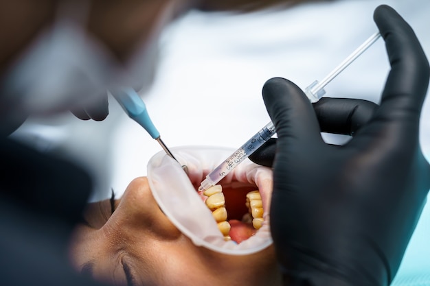 Zdjęcie pacjentka na wizytę u dentysty. lekarz dentysta wstrzykuje lek w twardą tkankę dziąseł, zapewniając szybki efekt znieczulenia.