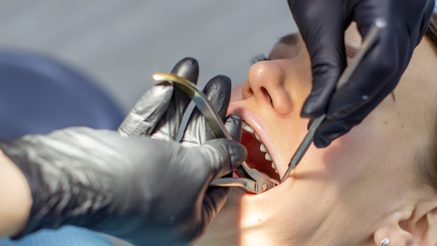 Piękna kobieta na fotelu dentystycznym podczas zabiegu zakładania aparatów ortodontycznych na zęby górne i dolne. Dentysta i asystentka pracują razem, narzędzia stomatologiczne w ich rękach. Widok z góry. Pojęcie stomatologii
